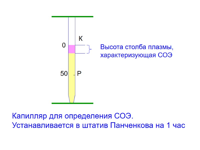 50 Р 0 К Высота столба плазмы,  характеризующая СОЭ Капилляр для определения СОЭ.